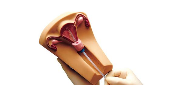 女性上環有什么危害 女性上環需要注意的問題