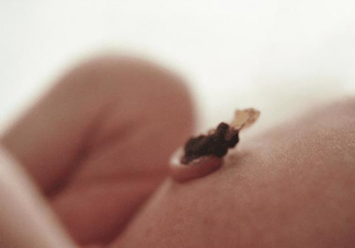 寶寶臍帶痂怎么保留 保留臍帶痂的方法