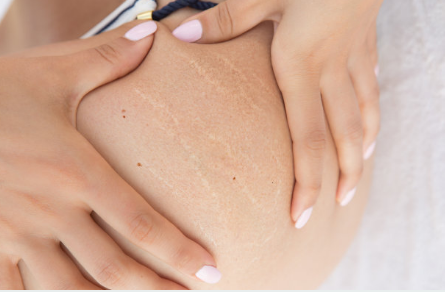 孕婦肚子上的黑線是什么 孕婦肚子長黑線有什么作用