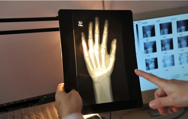 骨齡大的孩子以后不容易長高嗎 兒童骨齡偏大怎么辦