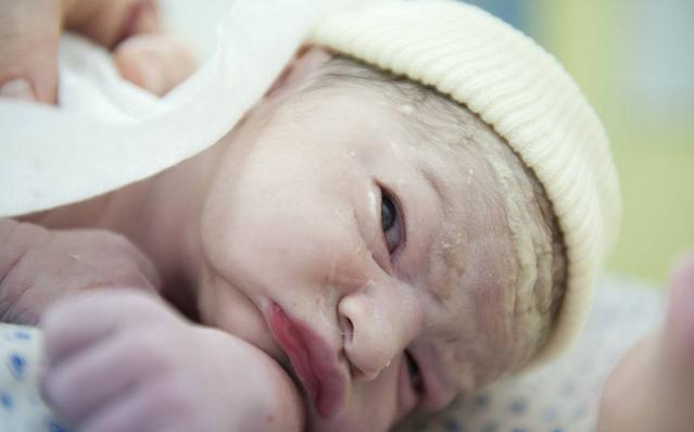 寶寶42天體檢有必要去嗎 寶寶42天體檢檢查什么