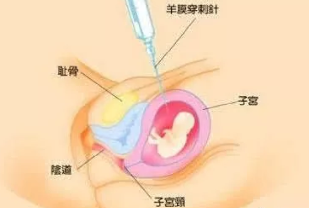 2019年3月14日受孕生男生女怎么看 農歷二月初八懷孕是男孩還是女孩