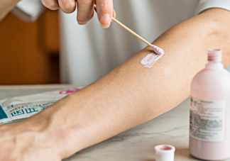 孩子是過敏體質(zhì)的表現(xiàn) 怎么判斷孩子是過敏體質(zhì)