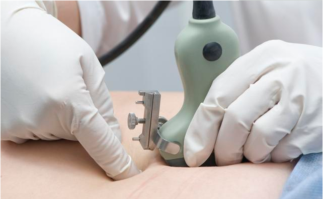 NT檢查結果顯示多少需要做羊水穿刺 哪些孕媽做羊水穿刺可能性大