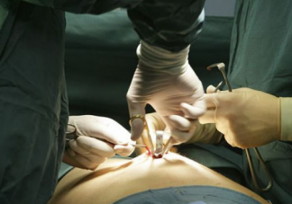 順產側切傷口怎么護理 順產側切傷口護理方法