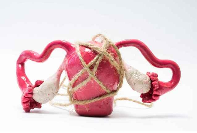 青春期女性也會得多囊卵巢嗎 多囊卵巢會影響肥胖嗎 青春期女性也會得多囊卵巢嗎 多囊卵巢會影響肥胖嗎