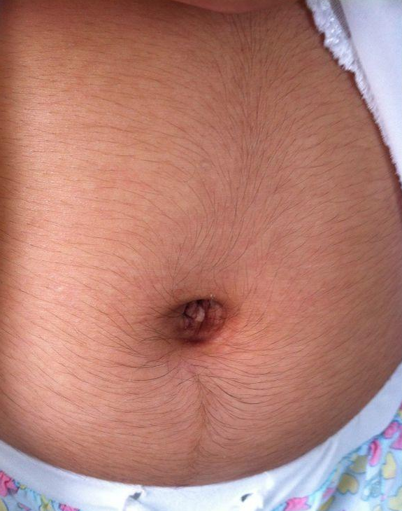 孕婦肚皮長毛和胎兒性別有關嗎 孕婦肚皮長毛是怎么回事