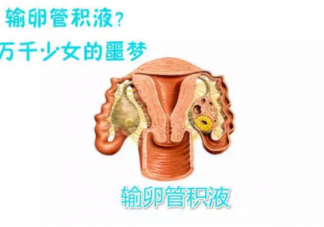 輸卵管積液有什么影響 輸卵管積水的危害