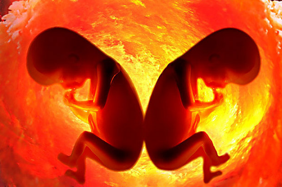 子宮內膜增厚是什么原因 子宮內膜增厚的原因