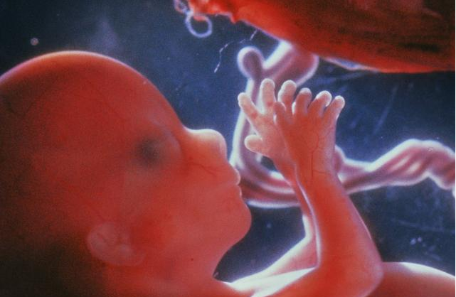 孕婦羊水渾濁一般發生在什么時候 孕婦羊水渾濁的原因 孕婦羊水渾濁一般發生在什么時候 孕婦羊水渾濁的原因