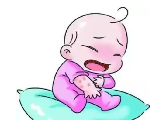 寶寶熱疹怎么處理 寶寶濕疹與熱疹怎樣區分