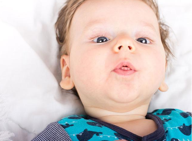 寶寶爛嘴角是上火了嗎 寶寶爛嘴角怎么辦