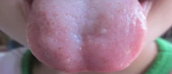 寶寶九種體質辨識與調理 寶寶9種體質有哪些