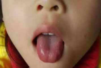 寶寶九種體質辨識與調理 寶寶9種體質有哪些