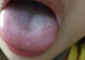 寶寶九種體質辨識與調理 寶寶9種體質有哪些