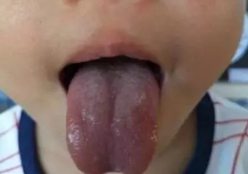 寶寶九種體質辨識與調理 寶寶9種體質有哪些