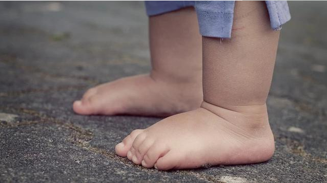 1歲寶寶學(xué)走路腿總是彎著走正常嗎 寶寶剛開始學(xué)走路要注意什么 1歲寶寶學(xué)走路腿總是彎著走正常嗎 寶寶剛開始學(xué)走路要注意什么