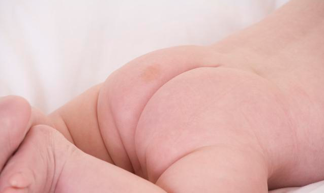 春季孩子上火的表現 寶寶上火了怎么降火調理