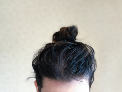 孩子頭發上好多白點點什么東西 為什么會產生頭虱子