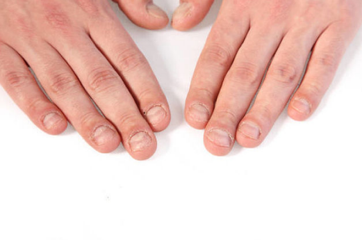 寶寶指甲相關問題匯總 倒刺/月牙/白點/豎紋問題