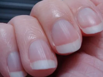 寶寶指甲相關問題匯總 倒刺/月牙/白點/豎紋問題