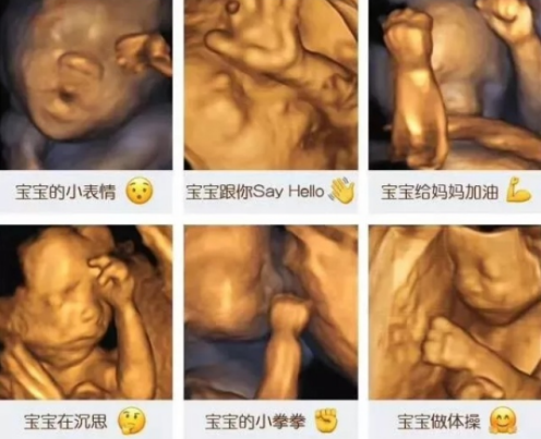 做四維寶寶不配合怎么辦 做四維胎兒不配合的原因 做四維寶寶不配合怎么辦 做四維胎兒不配合的原因