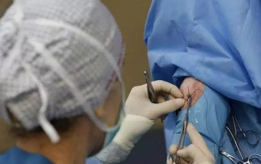 順產撕裂和側切有什么不同 順產撕裂和側切的區別