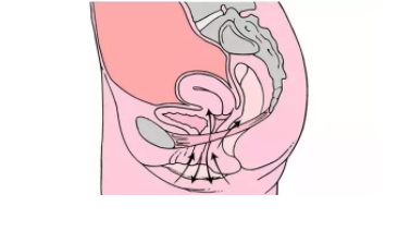 順產撕裂怎么預防 順產撕裂的預防方法