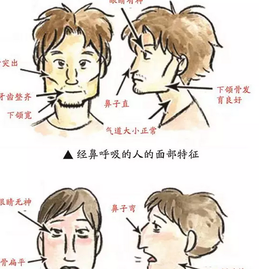 用口呼吸會對顏值有影響嗎 為什么用嘴呼吸會變丑