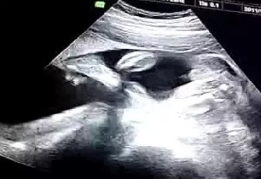 2019年4月3日孕生男生女 農(nóng)歷二月二十八懷孕是男孩還是女孩