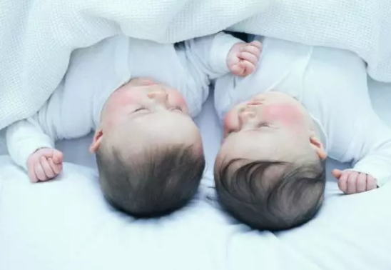 寶寶頭發稀少發黃怎么辦 寶寶頭發少發黃解決辦法