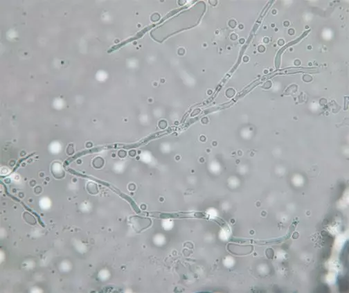 寶寶嘴里白色的東西是奶漬嗎 寶寶鵝口瘡的表現是什么 寶寶嘴里白色的東西是奶漬嗎 寶寶鵝口瘡的表現是什么