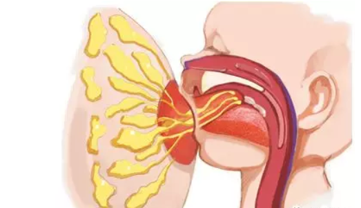 乳腺炎膿腫排膿期間能喂奶嗎 乳腺炎膿腫刺抽出膿液能哺乳嗎 乳腺炎膿腫排膿期間能喂奶嗎 乳腺炎膿腫刺抽出膿液能哺乳嗎