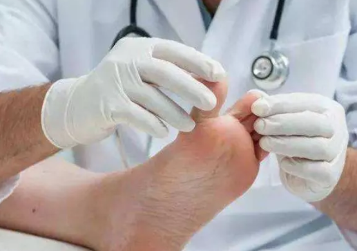 寶寶腳指甲往肉里長怎么回事 指甲往肉里長的原因