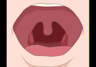 扁桃體切除后對兒童有什么影響 扁桃體炎反復需要切除嗎