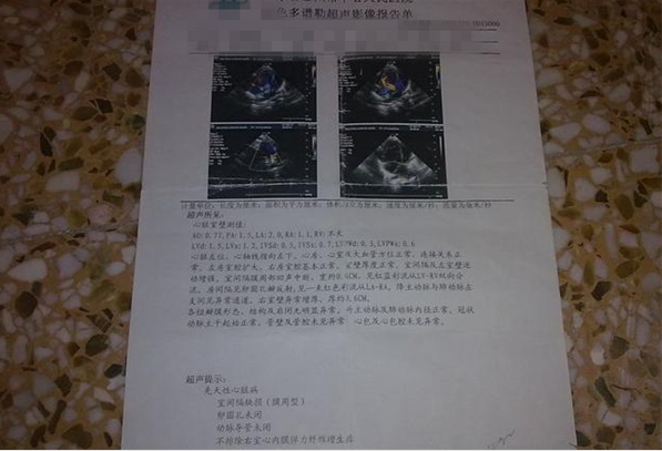 卵圓孔未閉合是什么意思 卵圓孔未閉合有什么影響 卵圓孔未閉合是什么意思 卵圓孔未閉合有什么影響