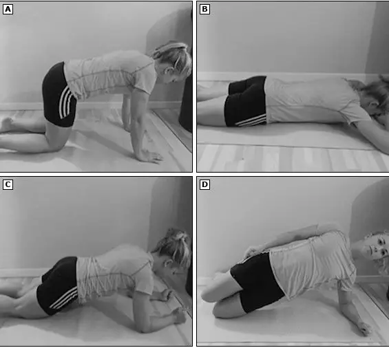 不能做腹直肌分離怎么恢復 一年半后做腹直肌分離還會有用嗎 不能做腹直肌分離怎么恢復 一年半后做腹直肌分離還會有用嗎