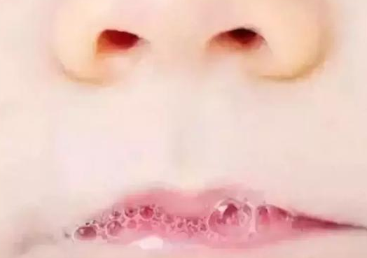 寶寶嘴巴吐泡泡是怎么回事 嘴巴吐泡泡的原因