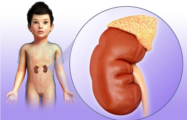 怎么看孩子的腎有沒有問題 哪些兒童容易出現腎病問題
