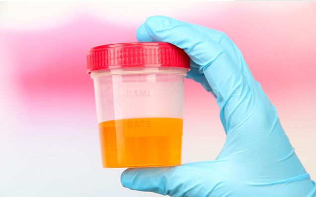 怎么看孩子的腎有沒有問題 哪些兒童容易出現腎病問題