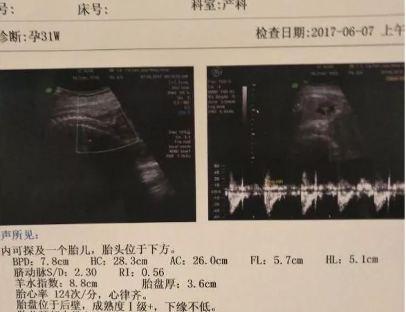夢見吃沒熟或爛的桃子什么意思 夢見吃沒熟或爛的桃子生男生女 夢見吃沒熟或爛的桃子什么意思 夢見吃沒熟或爛的桃子生男生女