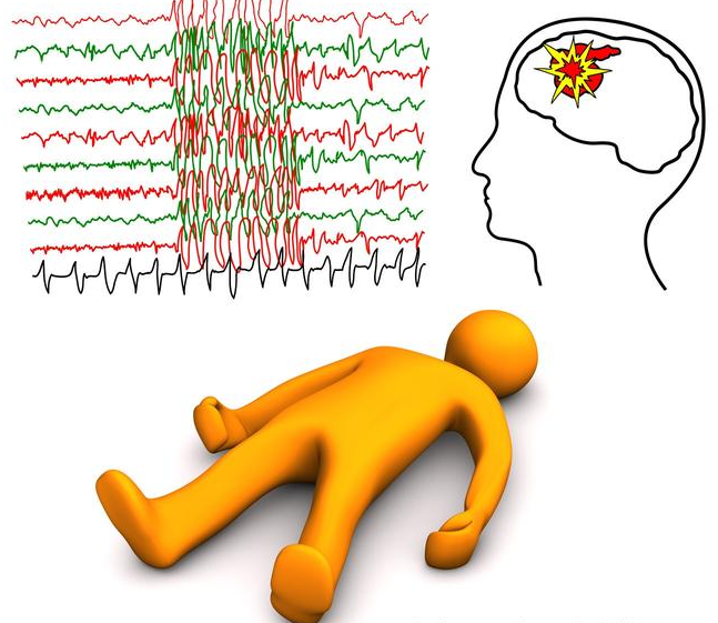 小兒癲癇的初期癥狀 小兒癲癇護(hù)理措施