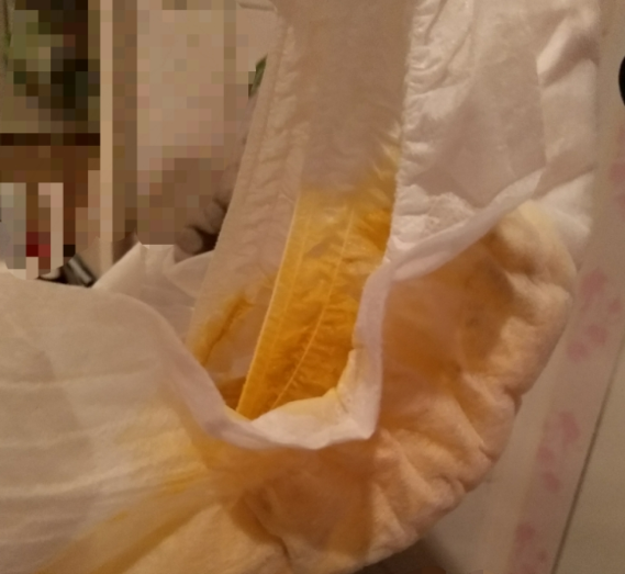 皮皮克紙尿褲會紅屁股嗎 皮皮克紙尿褲會漏尿嗎 皮皮克紙尿褲會紅屁股嗎 皮皮克紙尿褲會漏尿嗎