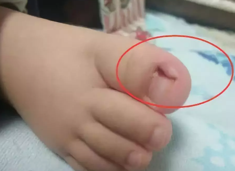 你真會給你的寶寶剪指甲嗎 如何給寶寶正確的剪指甲