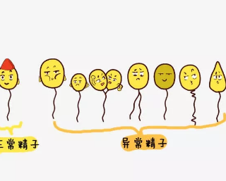 精液像果凍一樣的男性要注意了 精液異常有哪些表現(xiàn) 精液像果凍一樣的男性要注意了 精液異常有哪些表現(xiàn)