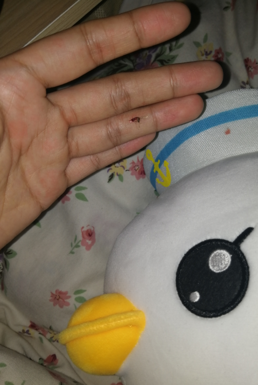 被蚊子咬的幽默句子怎么發(fā) 被蚊子咬的朋友圈說說 被蚊子咬的幽默句子怎么發(fā) 被蚊子咬的朋友圈說說