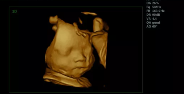 0歲照片能看胎兒性別嗎 0歲照片看生男生女為非法性別鑒定