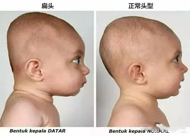 寶寶的頭多大會定型 寶寶頭型要怎么去睡 寶寶的頭多大會定型 寶寶頭型要怎么去睡