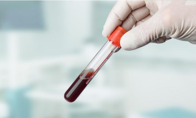 血清鐵蛋白低算不算貧血 孕婦補充鐵劑為什么沒有改善貧血