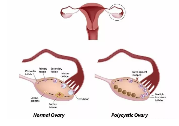清宮手術對子宮有危害嗎 清宮手術后多久才能要小孩